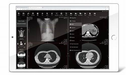 dicom 调窗html5源码